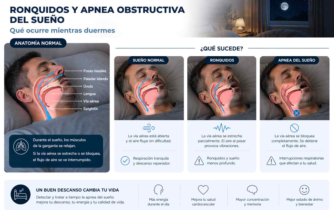 Ronquidos y apnea obstructiva del sueño